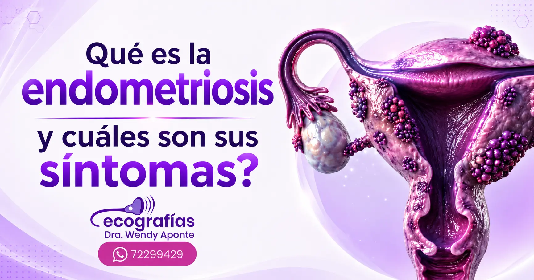 endometriosis
